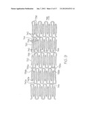 LONGITUDINALLY FLEXIBLE EXPANDABLE STENT diagram and image