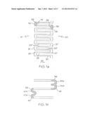 LONGITUDINALLY FLEXIBLE EXPANDABLE STENT diagram and image