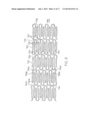 LONGITUDINALLY FLEXIBLE EXPANDABLE STENT diagram and image