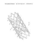 LONGITUDINALLY FLEXIBLE EXPANDABLE STENT diagram and image