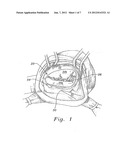 THREE-DIMENSIONAL ANNULOPLASTY RING diagram and image