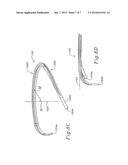 THREE-DIMENSIONAL ANNULOPLASTY RING diagram and image