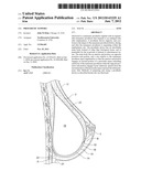 Prosthetic Support diagram and image