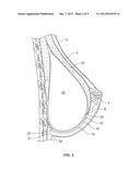 Prosthetic Support diagram and image