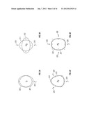 Interpretation of Real Time Compaction Monitoring Data Into Tubular     Deformation Parameters and 3D Geometry diagram and image