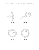 Interpretation of Real Time Compaction Monitoring Data Into Tubular     Deformation Parameters and 3D Geometry diagram and image