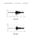 PARTIAL DISCHARGE DETECTION DEVICE CAPABLE OF DETERMINING THE EXTERNAL OR     INTERNAL ORIGIN OF A PARTIAL DISCHARGE, AND ASSOCIATED METHOD diagram and image