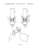 MODULAR AEROSOL DELIVERY SYSTEM diagram and image