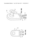 SOUND DAMPENING IN POSITIVE AIRWAY PRESSURE DEVICES diagram and image