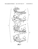 Intra-oral mandibular advancement appliance diagram and image