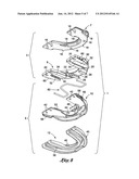 Intra-oral mandibular advancement appliance diagram and image