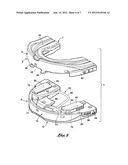 Intra-oral mandibular advancement appliance diagram and image