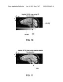 SYSTEM AND METHOD FOR REDUCING LOCALIZED SIGNAL FLUCTUATION diagram and image