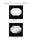 MAGNETIC RESONANCE IMAGING APPARATUS AND MAGNETIC RESONANCE IMAGING METHOD diagram and image