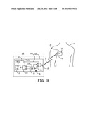 PRESELECTOR INTERFERENCE REJECTION AND DYNAMIC RANGE EXTENSION diagram and image