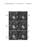 Prior Enhanced Compressed Sensing (PRINCE-CS) Reconstruction for Dynamic     2D-Radial Cardiac MRI diagram and image