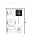 Prior Enhanced Compressed Sensing (PRINCE-CS) Reconstruction for Dynamic     2D-Radial Cardiac MRI diagram and image