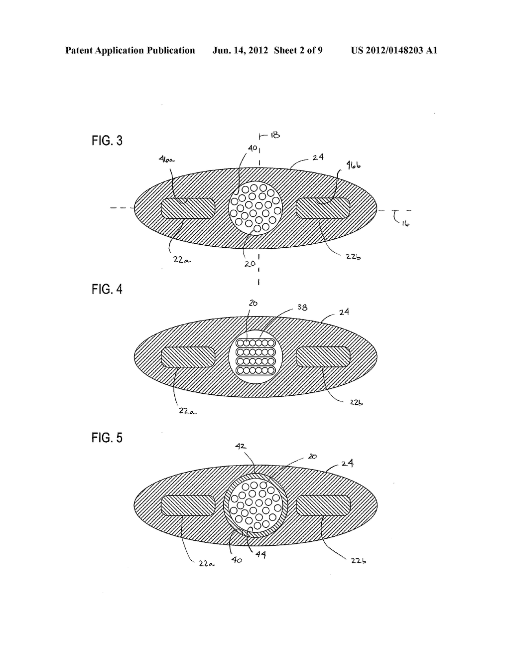 METHOD OF TERMINATING A FIBER OPTIC CABLE - diagram, schematic, and image 03