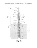 UNDERCUTTING TOOL diagram and image