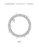 MOUNTING ARRANGEMENT FOR PITCH GEAR diagram and image