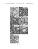 Targeting Kidney Mesangium With Nanoparticles of Defined Diameter diagram and image