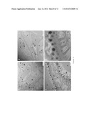 Targeting Kidney Mesangium With Nanoparticles of Defined Diameter diagram and image