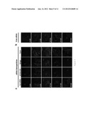 Targeting Kidney Mesangium With Nanoparticles of Defined Diameter diagram and image