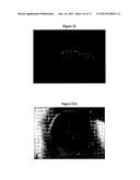 SYNTHETIC GRAFT diagram and image