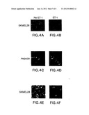 Cancer Treatment With Endothelin Receptor Antagonists diagram and image