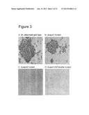 Interaction of Moraxella Catarrhalis with Epithelial Cells, Extracellular     Matrix Proteins and the Complement System diagram and image