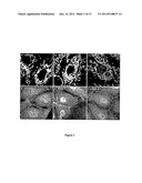 PEPTIDES THAT DOWN REGULATE THE ACTIVITY OF PLASMA MEMBRANE TRANSPORTERS     INCLUDING SODIUM-D-GLUCOSE COTRANSPORTER SGLT1 diagram and image