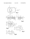 METHOD FOR MAKING LAMINATED GLAZING AND LAMINATED GLAZING INCLUDING AT     LEAST ONE HOLE diagram and image