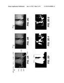 METHOD FOR IDENTIFICATION OF DENTAL CARIES IN POLYCHROMATIC IMAGES diagram and image