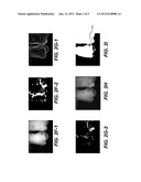 METHOD FOR IDENTIFICATION OF DENTAL CARIES IN POLYCHROMATIC IMAGES diagram and image