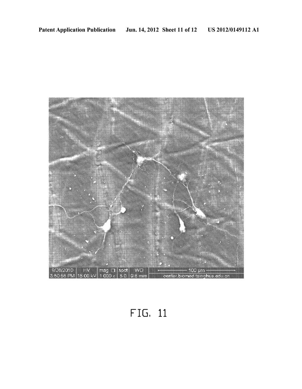 METHOD FOR MAKING NERVE GRAFT - diagram, schematic, and image 12