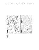 TRICYCLO-DNA ANTISENSE OLIGONUCLEOTIDES, COMPOSITIONS, AND METHODS FOR THE     TREATMENT OF DISEASE diagram and image