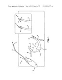 SURGICAL ARTICLES AND METHODS diagram and image