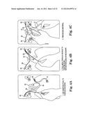 SURGICAL ARTICLES AND METHODS diagram and image
