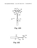 SURGICAL ARTICLES AND METHODS diagram and image