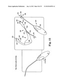 SURGICAL ARTICLES AND METHODS diagram and image