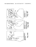 SURGICAL ARTICLES AND METHODS diagram and image