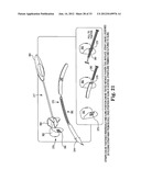 SURGICAL ARTICLES AND METHODS diagram and image