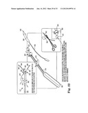 SURGICAL ARTICLES AND METHODS diagram and image