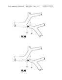 DEVICES AND SYSTEMS FOR LUNG TREATMENT diagram and image