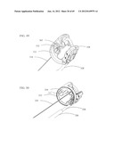 Needle Capture Device diagram and image