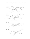 Needle Capture Device diagram and image