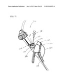 Needle Capture Device diagram and image