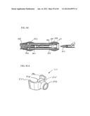 Needle Capture Device diagram and image