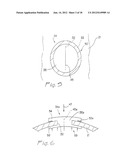 SURGICAL ACCESS APARATUS AND METHOD diagram and image