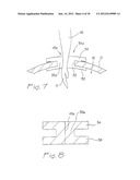 SURGICAL ACCESS APARATUS AND METHOD diagram and image